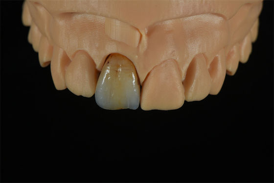 qualité  Affordable Zirconia Crowns with Custom Color Staining - China Dental Lab usine